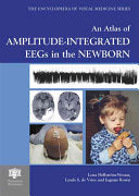An Atlas of Amplitude-integrated EEGs in the Newborn 9781842141113 Lena Hellström-Westas L. S. De Vries Ingmar Rosén Brukte bøker