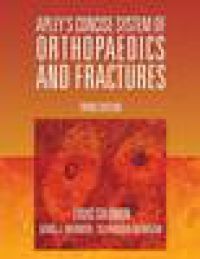 Apley's Concise System of Orthopaedics and Fractures 9780340809846 Louis Solomon Selvadurai Nayagam Brukte bøker