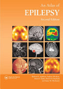 Atlas of Epilepsy 9781842140277 Richard Appleton Andrew Nicolson David Chadwick James MacKenzie David Smith Brukte bøker