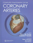 Computed Tomography of the Coronary Arteries 9781841844398 de Feyter Pim G. P. Gabriel Krestin Brukte bøker