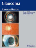 Glaucoma 9783131246714 John C. Morrison Irvin P. Pollack Brukte bøker