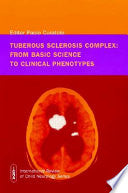 Tuberous Sclerosis Complex 9781898683391 Paolo Curatolo Brukte bøker