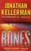 Bones