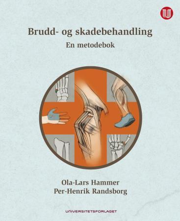 Brudd- og skadebehandling : en metodebok
