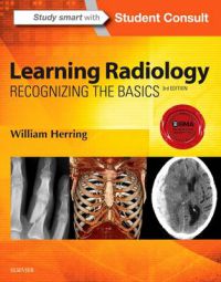 Bokomslag for "Learning Radiology: Recognizing the Basics" i lommeutgave, innen medisin og sykepleie, med radiologibilder og tekst.